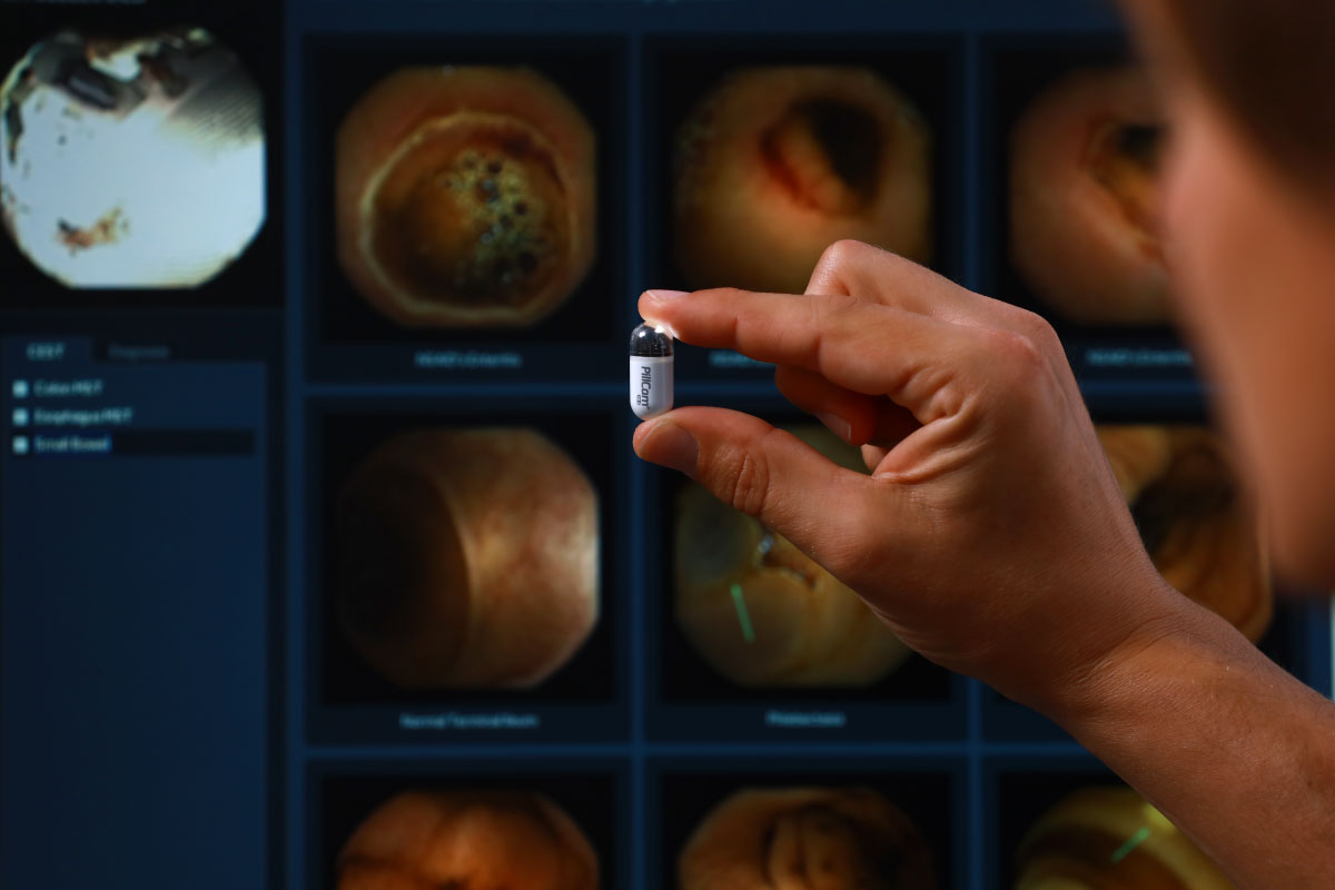 Detailaufnahme einer Videokapsel für eine Kapselendoskopie